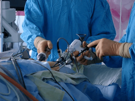 Intervento chirurgico